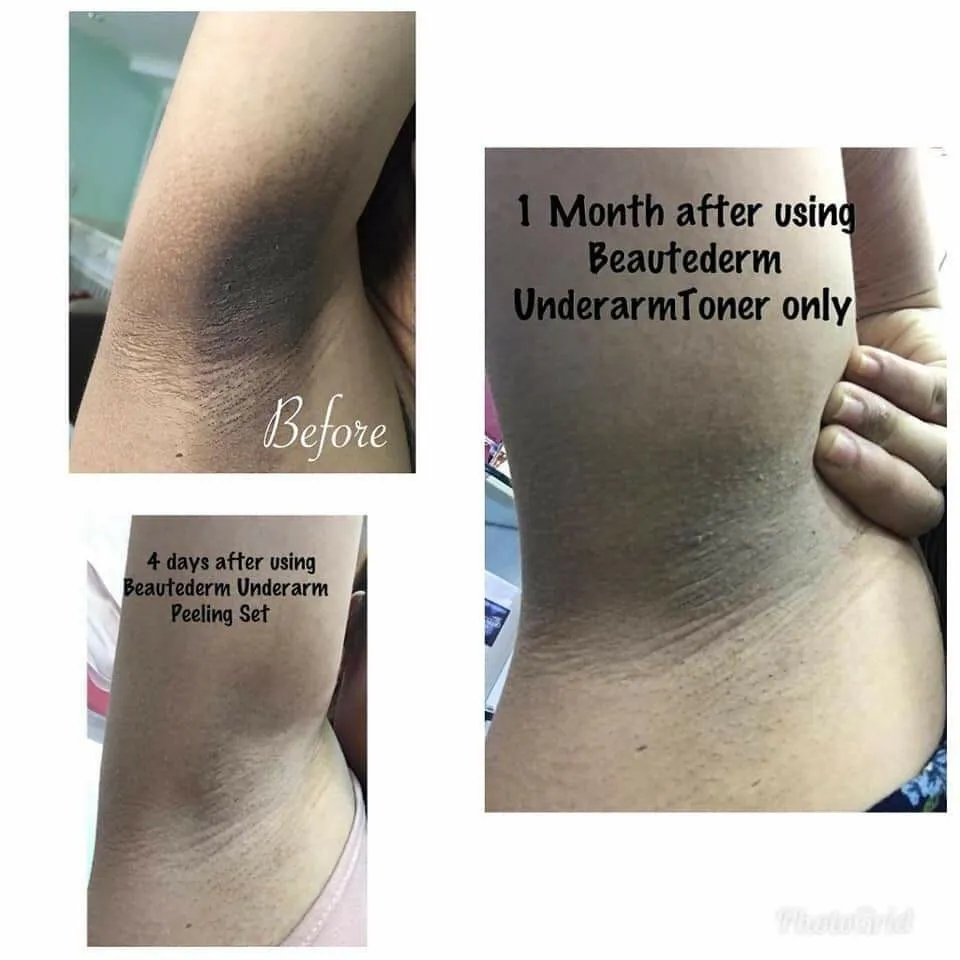 26733 topical creams underarm whitening