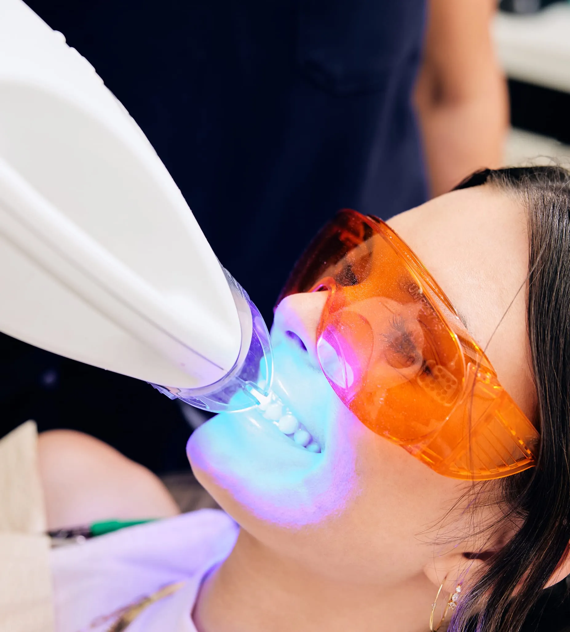 26736 teeth whitening newport news va 6