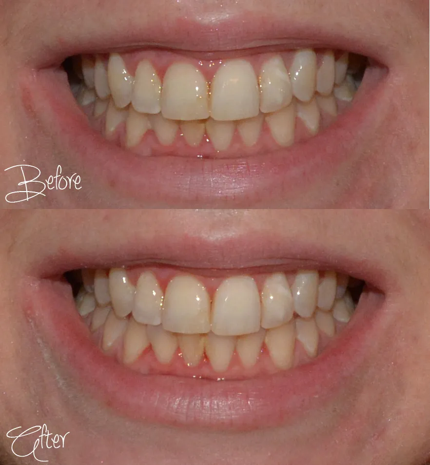 /img/26737-baking-soda-teeth-whitening-guide.webp
