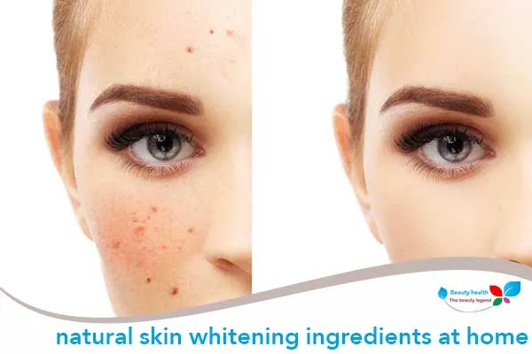 /img/26741-natural-whitening-skin-recipes-image-7.webp
