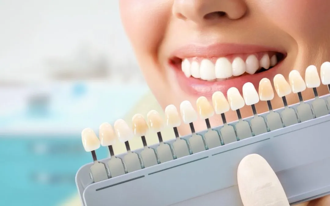 /img/26742-teeth-whitening-financing.webp