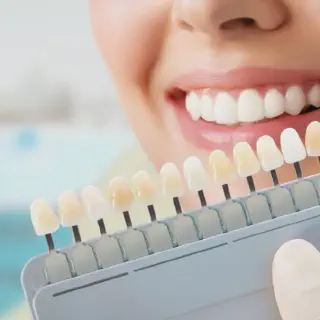 /img/26742-teeth-whitening-financing.webp