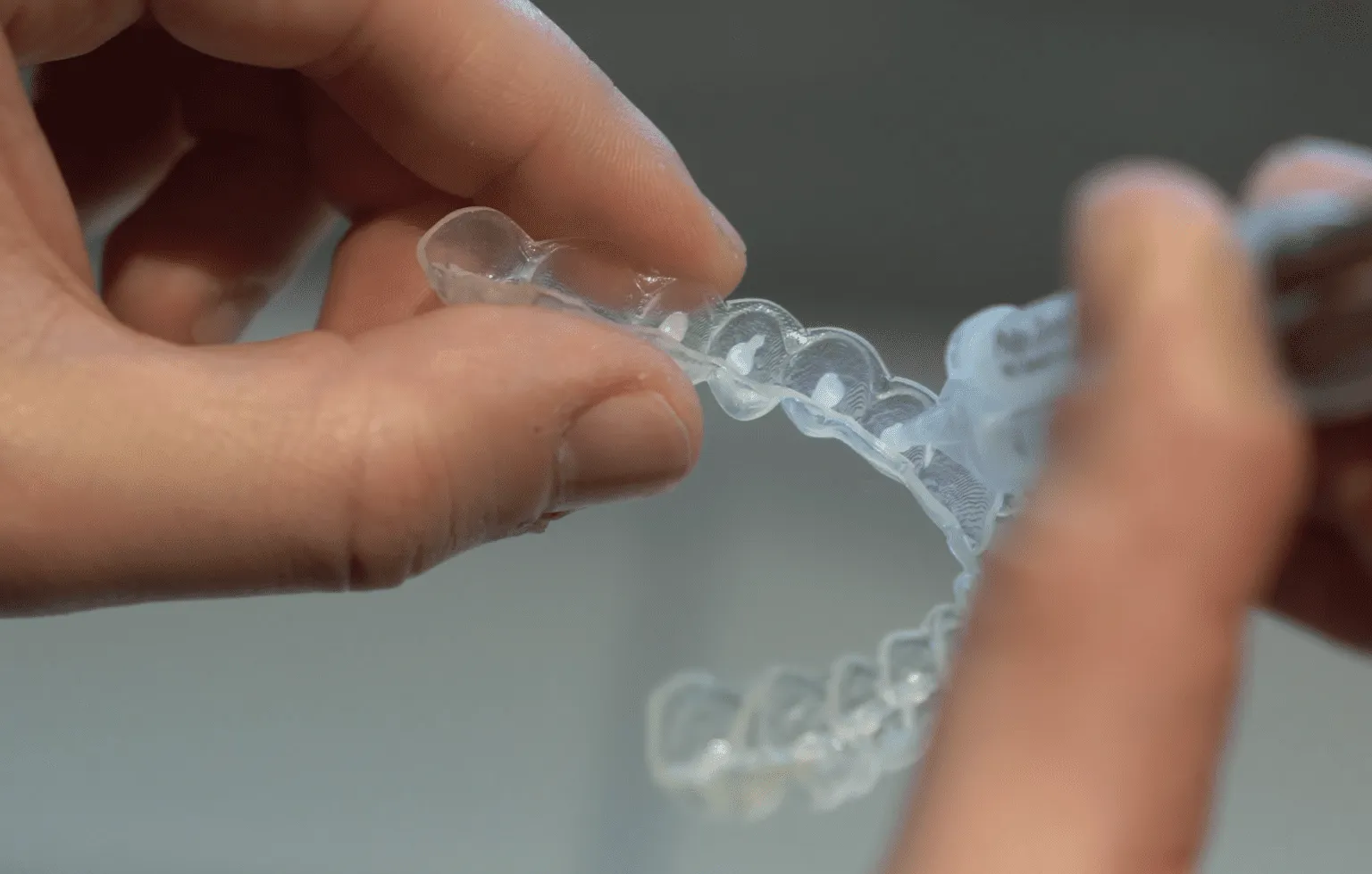 26750 sensitive teeth treatment