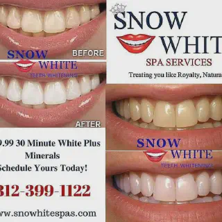 /img/26751-teeth-whitening-redlands-maintenance.webp