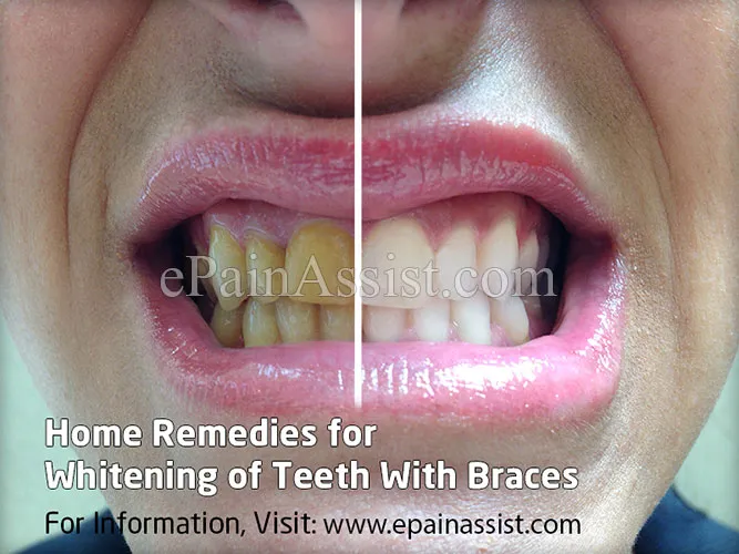 26755 whitening ingredients effects