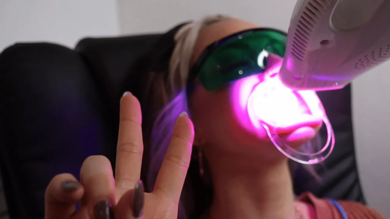 26758 teeth whitening las vegas image 6