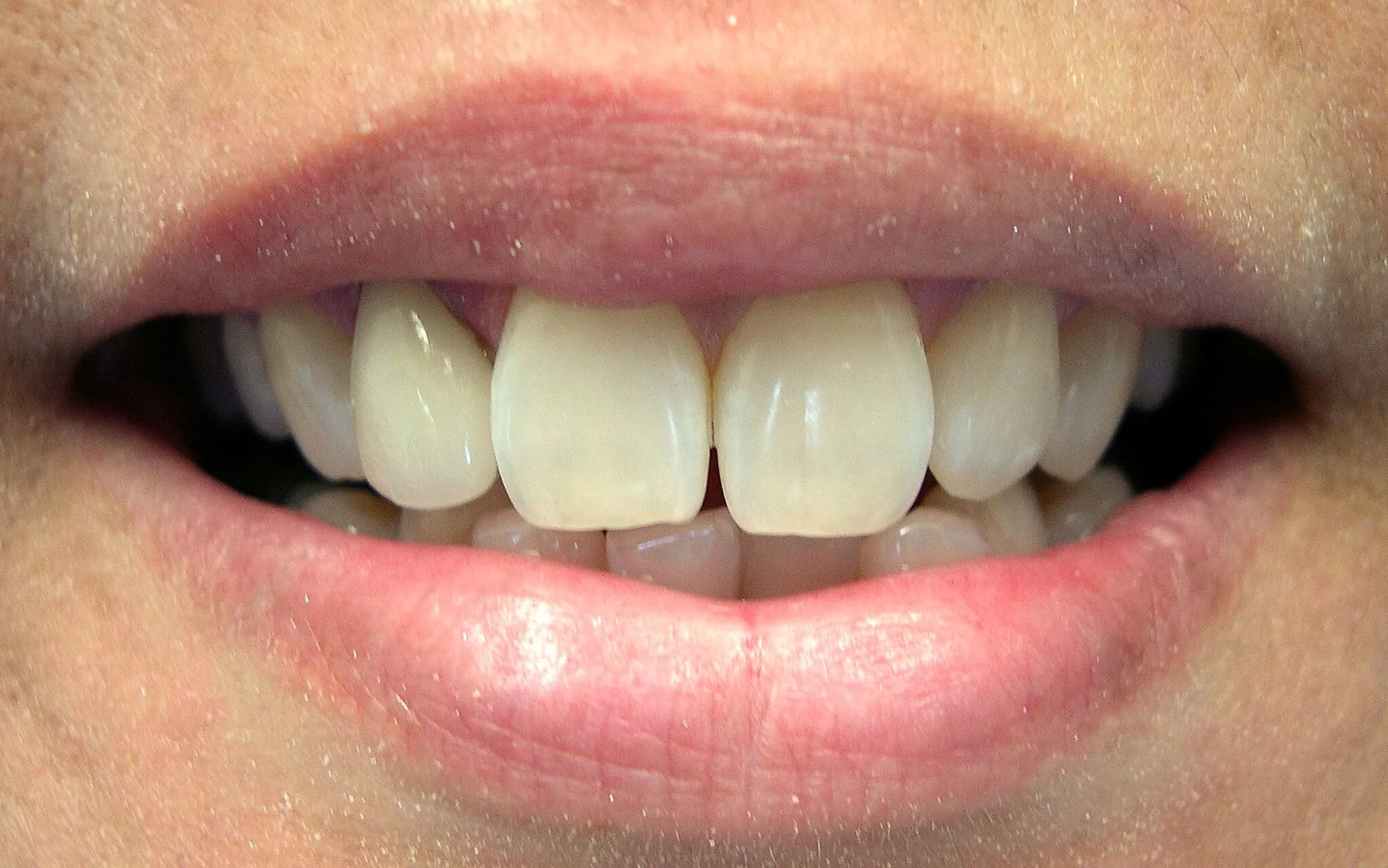 26761 healthy teeth smile
