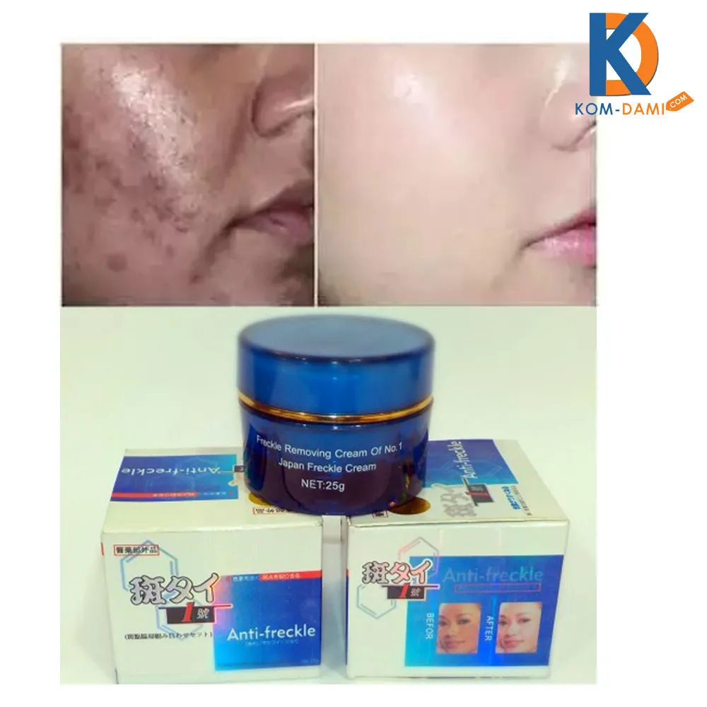 26767 melasma skin