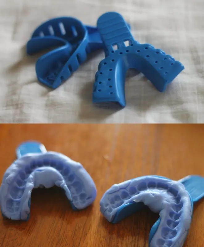 26768 teeth whitening maintenance 5