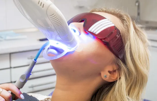 26775 at home teeth whitening