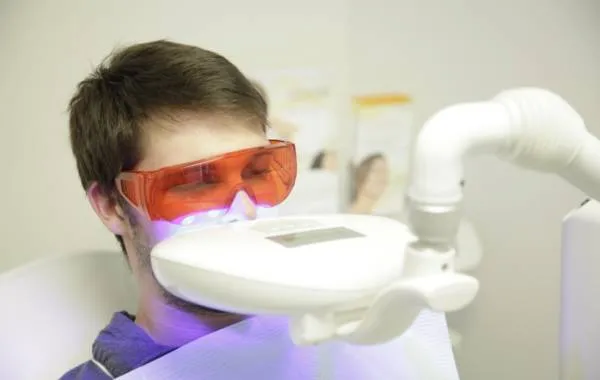 26775 teeth whitening cost