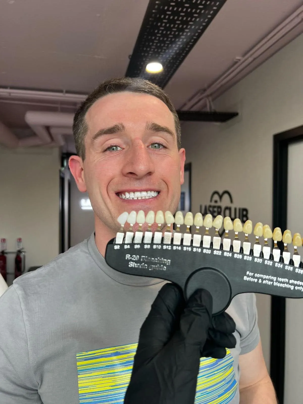 26782 teeth whitening consultation