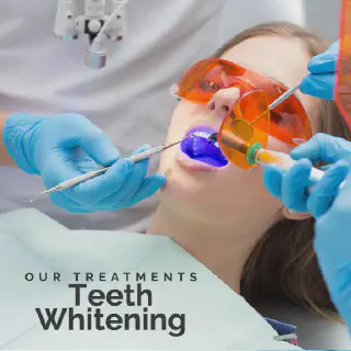 /img/26785-teeth-whitening-gainesville-dentist.webp