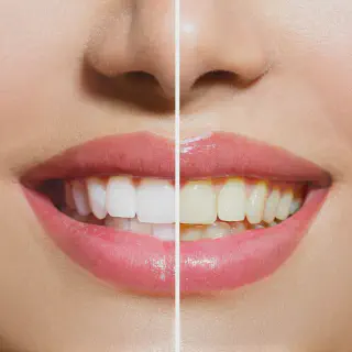 /img/26787-teeth-whitening-brandon-social-interaction.webp