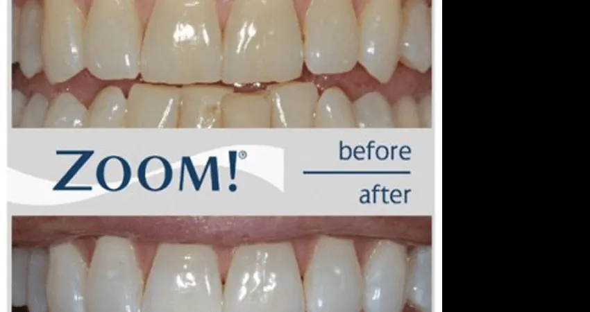 26791 dental consultation