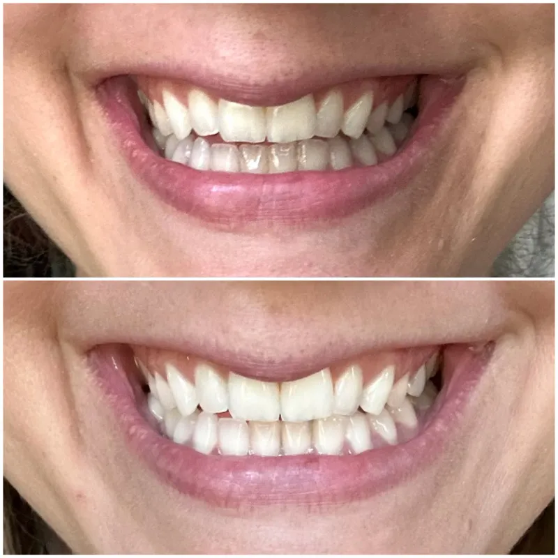 /img/26796-clinically-proven-teeth-whitening.webp